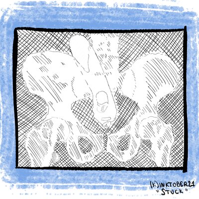2021-10-08_12.Stuck.png.small